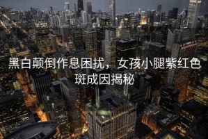 黑白颠倒作息困扰，女孩小腿紫红色斑成因揭秘